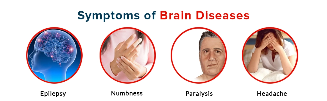 Symptoms of Brain Diseases